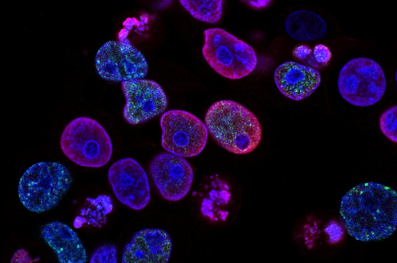 De Endocrine Society en haar genderrichtlijnen: waarom critici vragen om een herziening